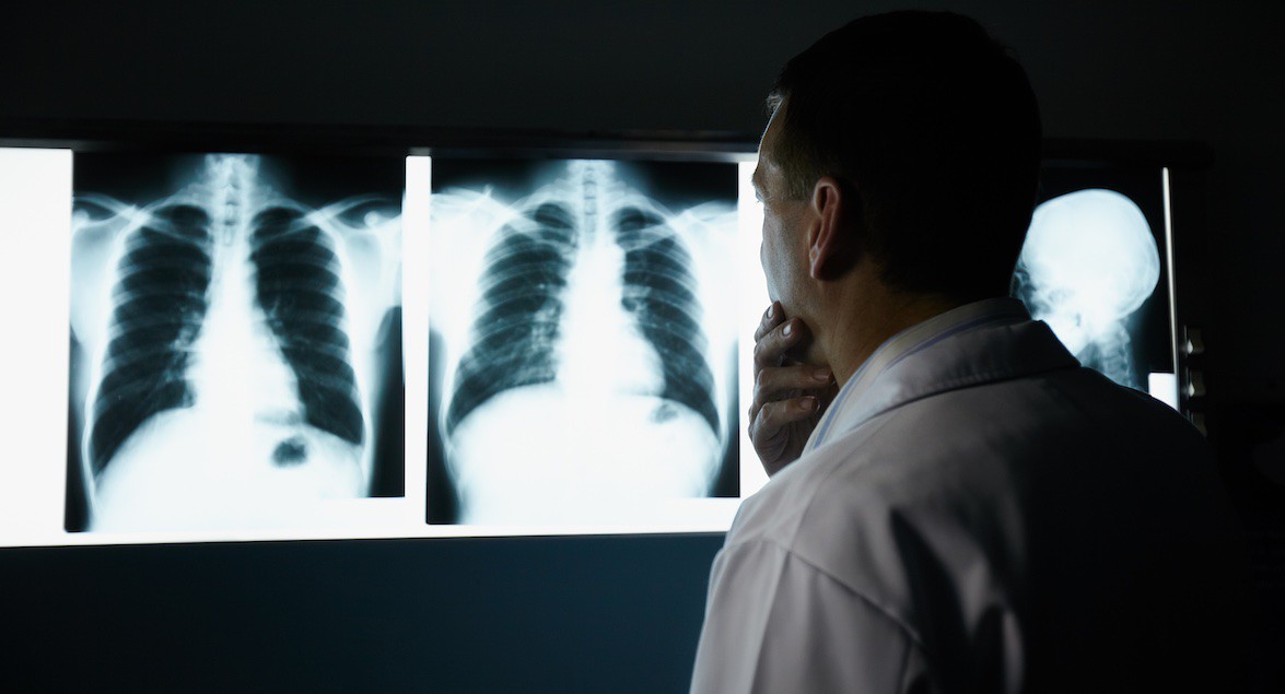 Actualización para Personal Técnico en Radiología Nivel II